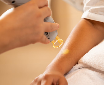 una persona aplica un dispositivo l&aacute;ser sobre el antebrazo de una persona durante un tratamiento